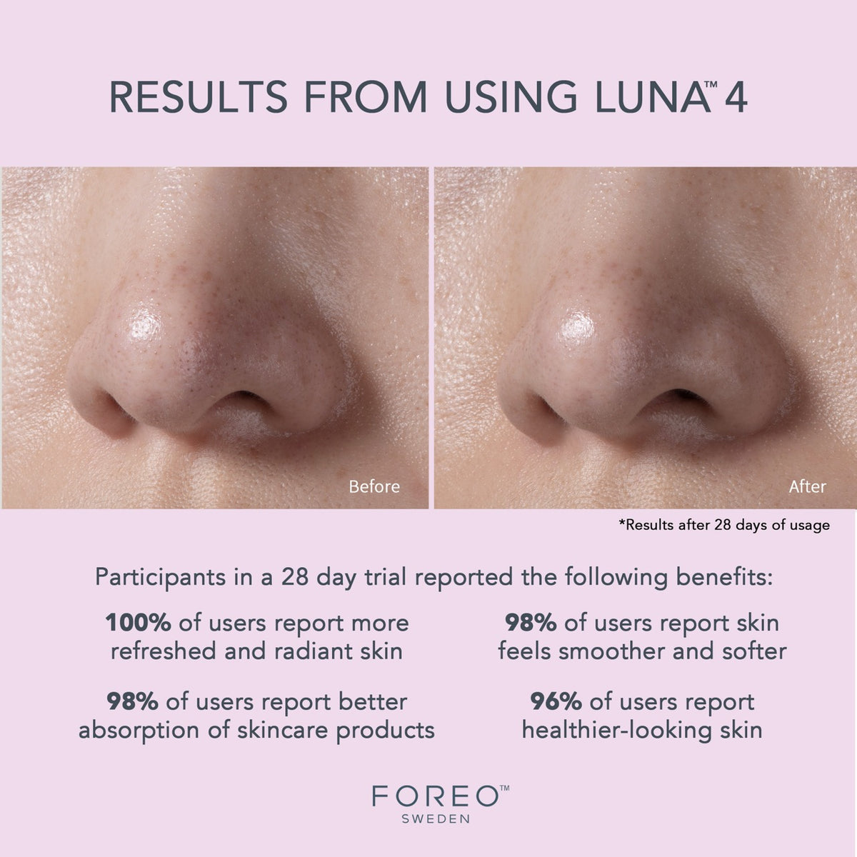 LUNA 4 Sensitive Skin